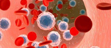 مهمترین علائم مرگ زودرس در سراسر جهان سرطان و بیماری عروقی