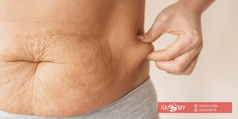 چرا چربی های شکم در آخرین مرحله از لاغری آب می شوند؟